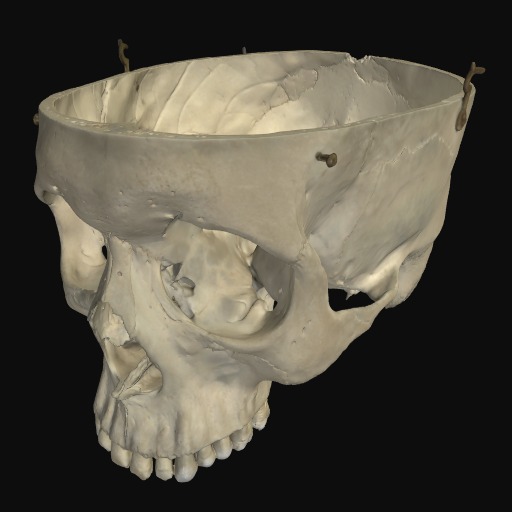 Thumbnail of 'Human cranium main'